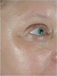 ����� ��������� ������������ �������������